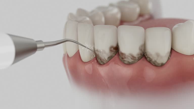 Reliable Wisdom Tooth Removal contractor in Grand Traverse County County, MI by Dentist Open Now